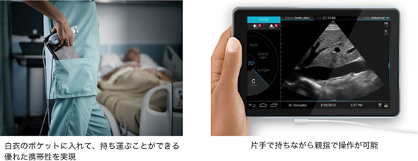 超音波画像診断装置　ポータブルエコー　sonosite nanomaxx 超音波画像診断装置を追加導入しました。 | 福井市の整形外科