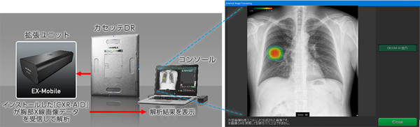 新リンパ療法　モアレ画像診断一式 新リンパ療法 モアレ画像診断一式 新リンパ療法 モアレ画像診断一式 新